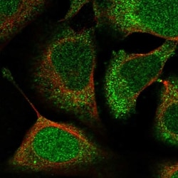 ACYP1 Antibody, Novus Biologicals 0.1mL; Unlabeled:Antibodies, Polyclonal